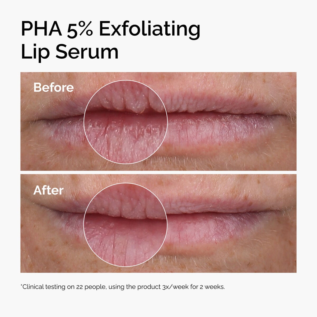 pha-5-exfoliating-lip-serum-d5 ord-pha-5pct-lip-exfoliating-serum-before-after.jpg